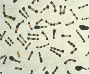 Corynebacterium diphtheriae al microscopio