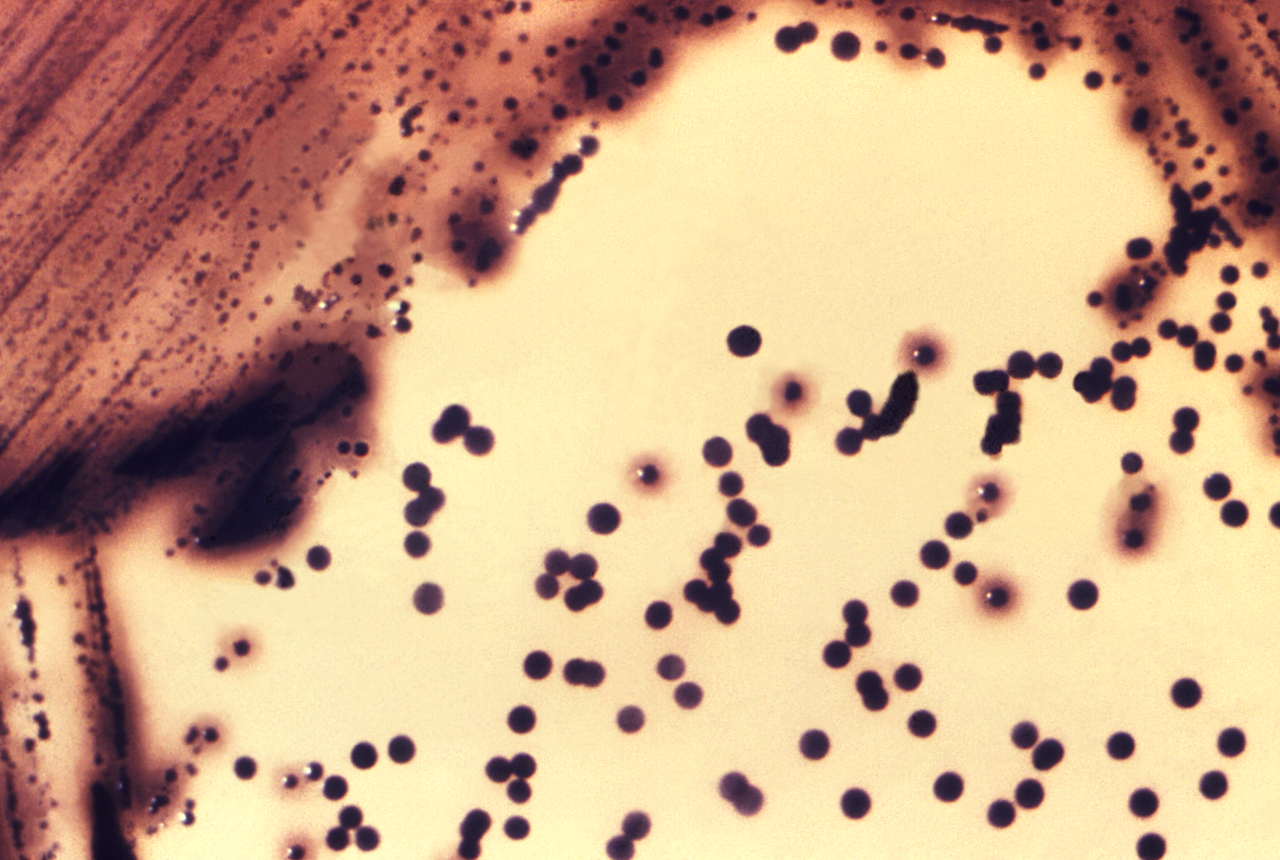 Coltura di Corynebacterium su piastra di laboratorio